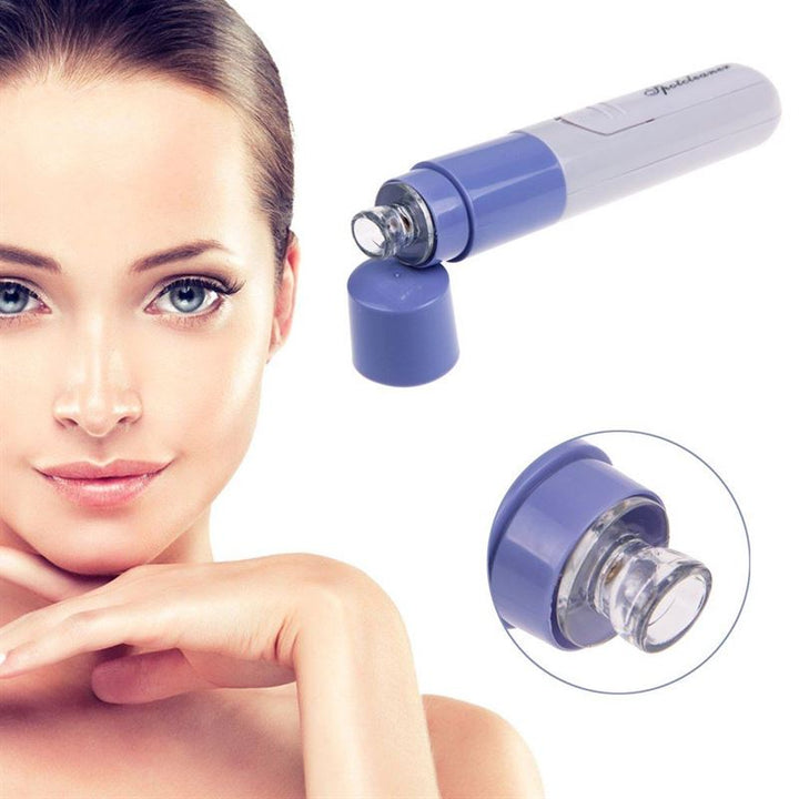 Blackhead Vacuum Cleanser Blackhead suction / blackhead remover - | Fashiongirl